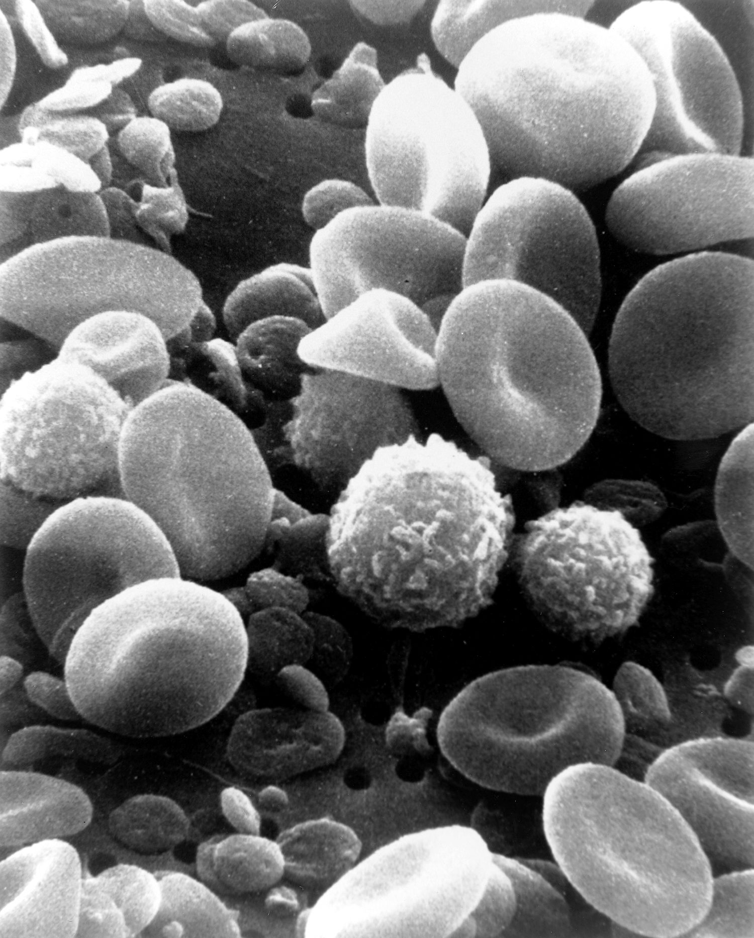 Red blood cells seen under a scanning electron microscope