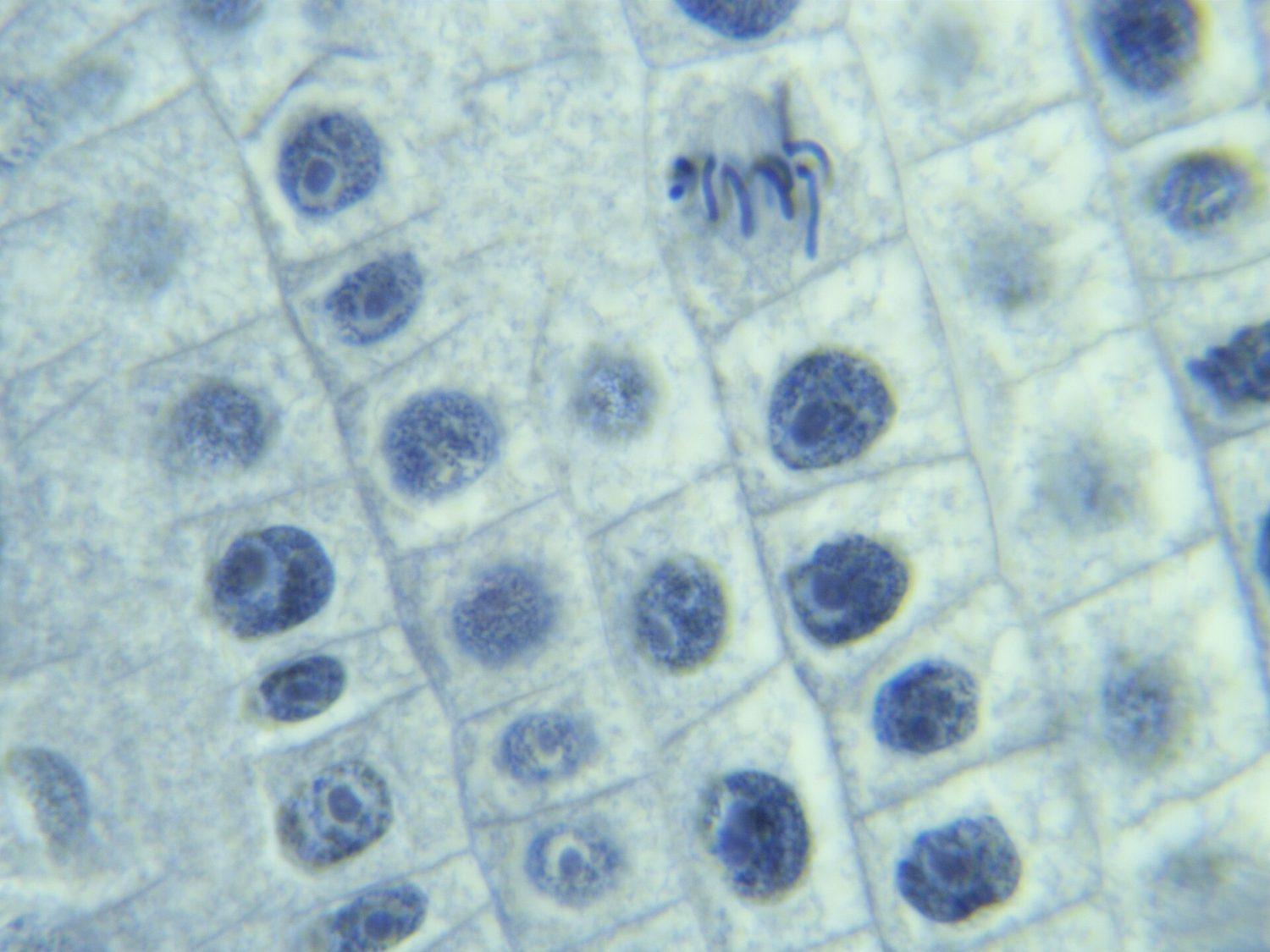 ยอดรากหัวหอมในช่วง metaphase: mitosis ผลิตเซลล์ร่างกายที่ identical สำหรับการเติบโตและการซ่อมแซม