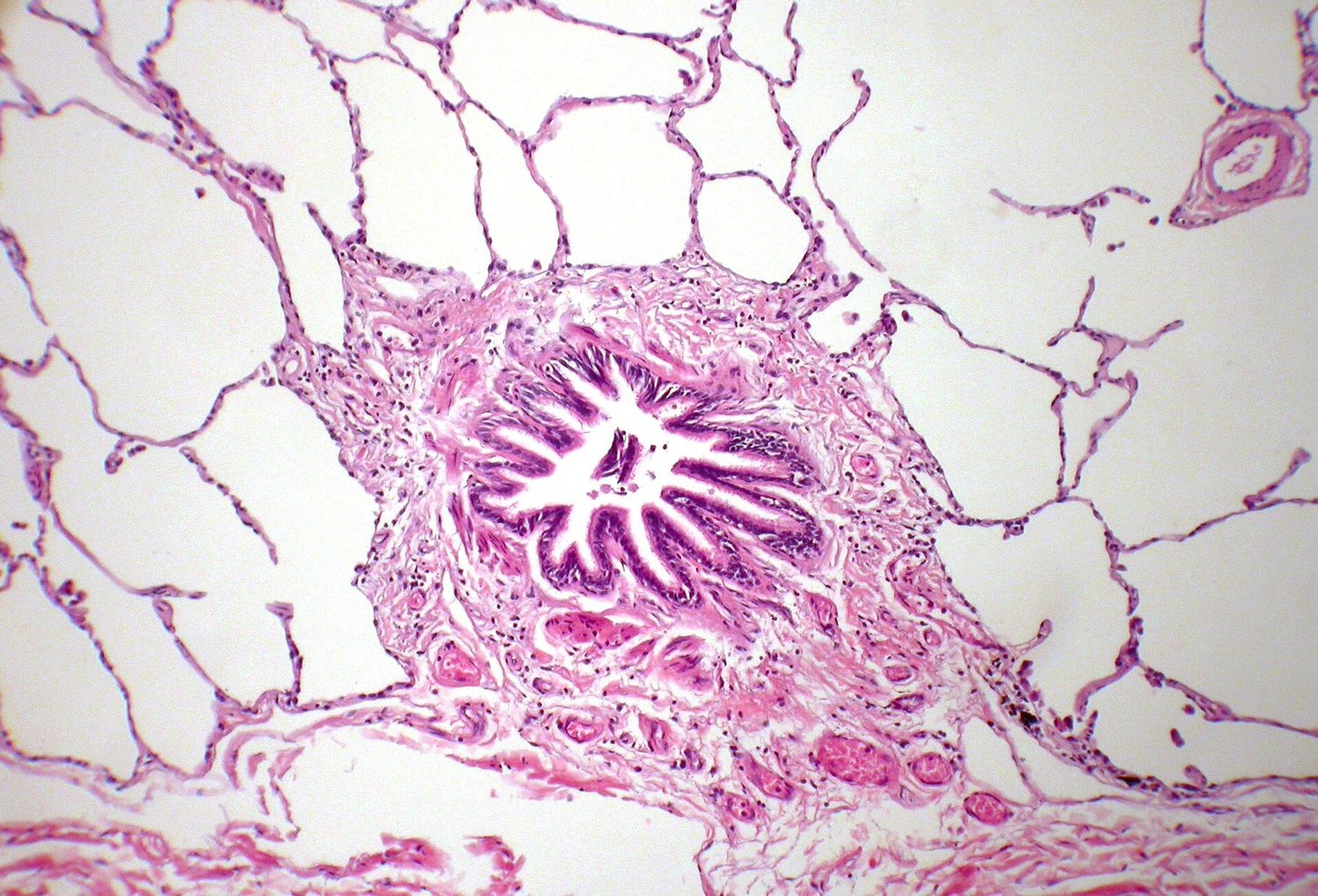 A stained light micrograph of normal lung tissue: a small round airway in the centre, surrounded on all sides by a delicate, lace-like network of thin pink walls enclosing many empty alveolar air spaces