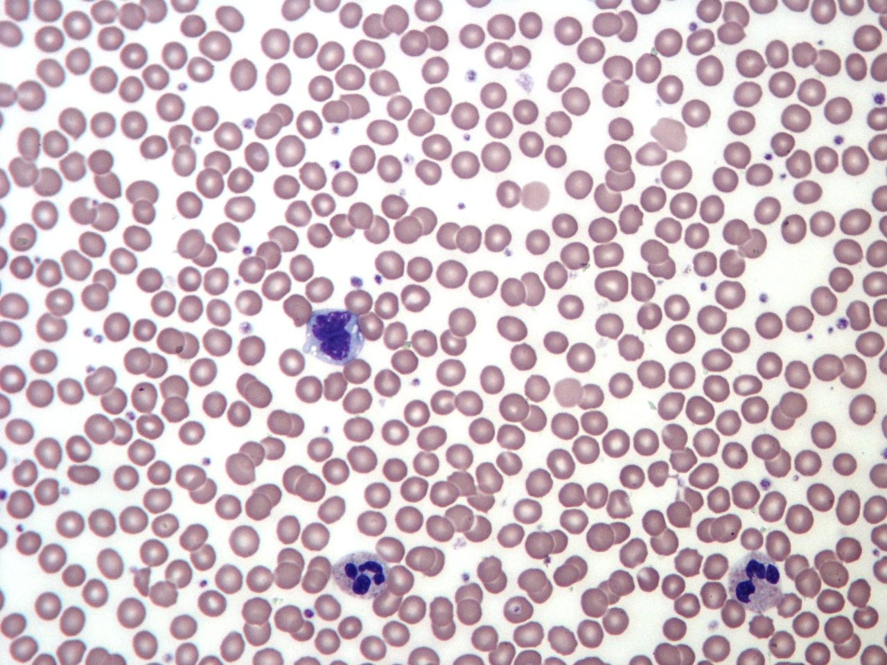 A stained blood smear with red cells and several larger purple white blood cells