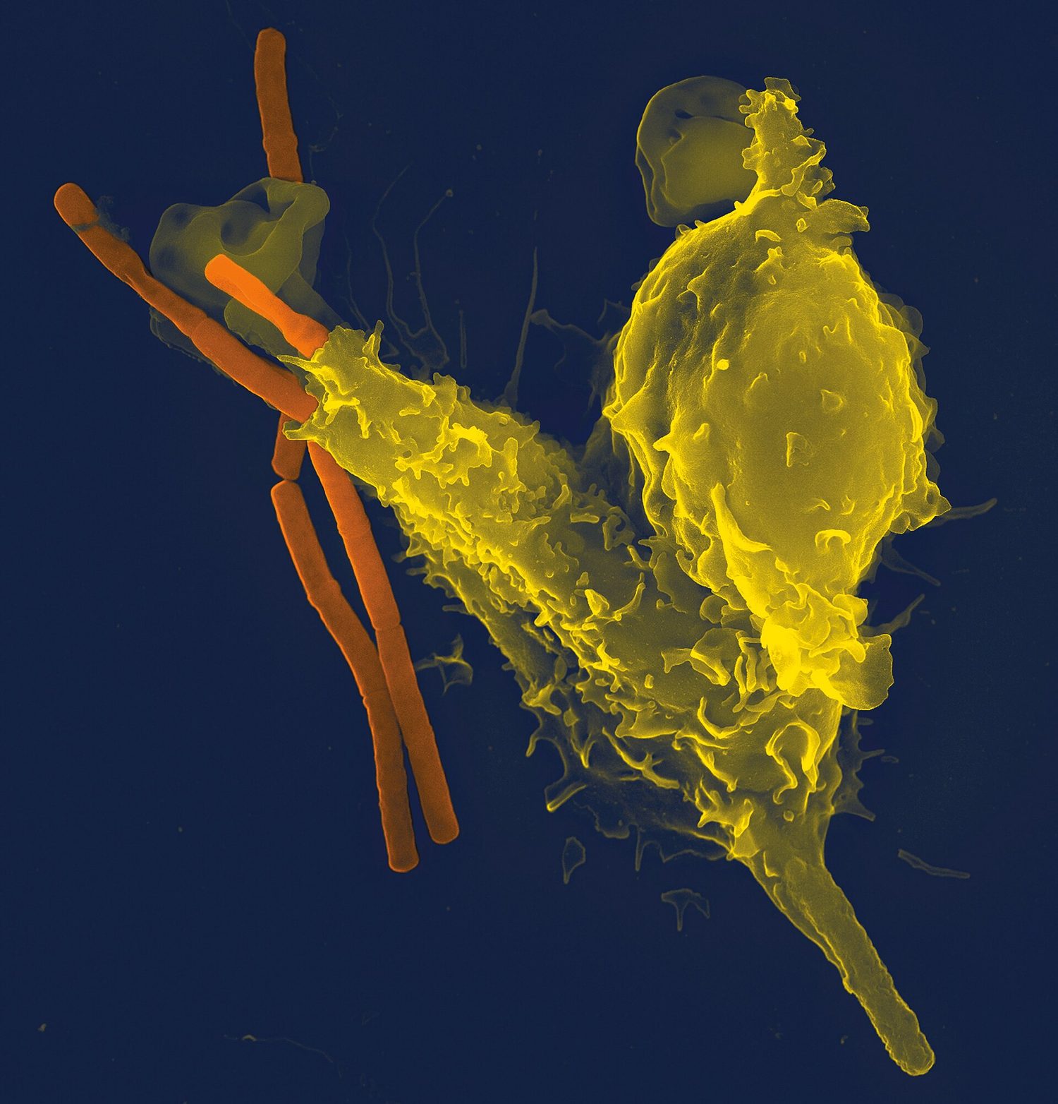A false-coloured scanning electron micrograph against a dark blue background: a yellow neutrophil with a ruffled surface stretching out finger-like projections to grasp several long, orange, rod-shaped anthrax bacteria