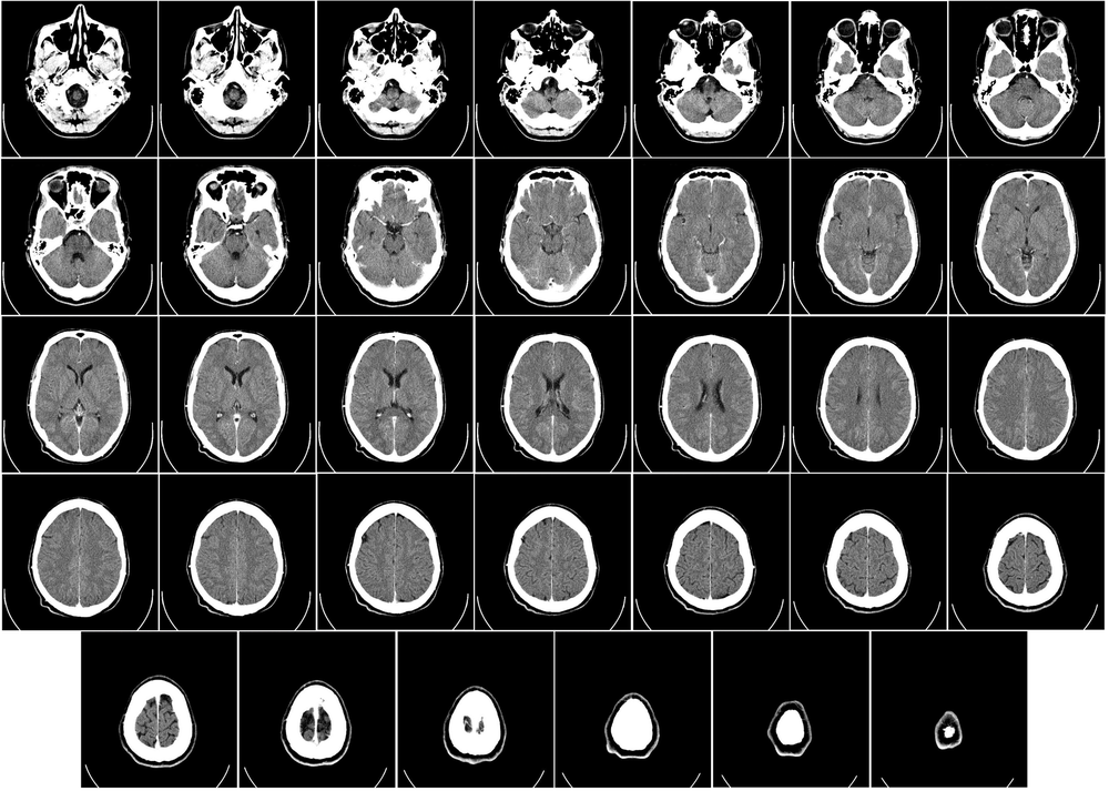 Scan slices of a human brain