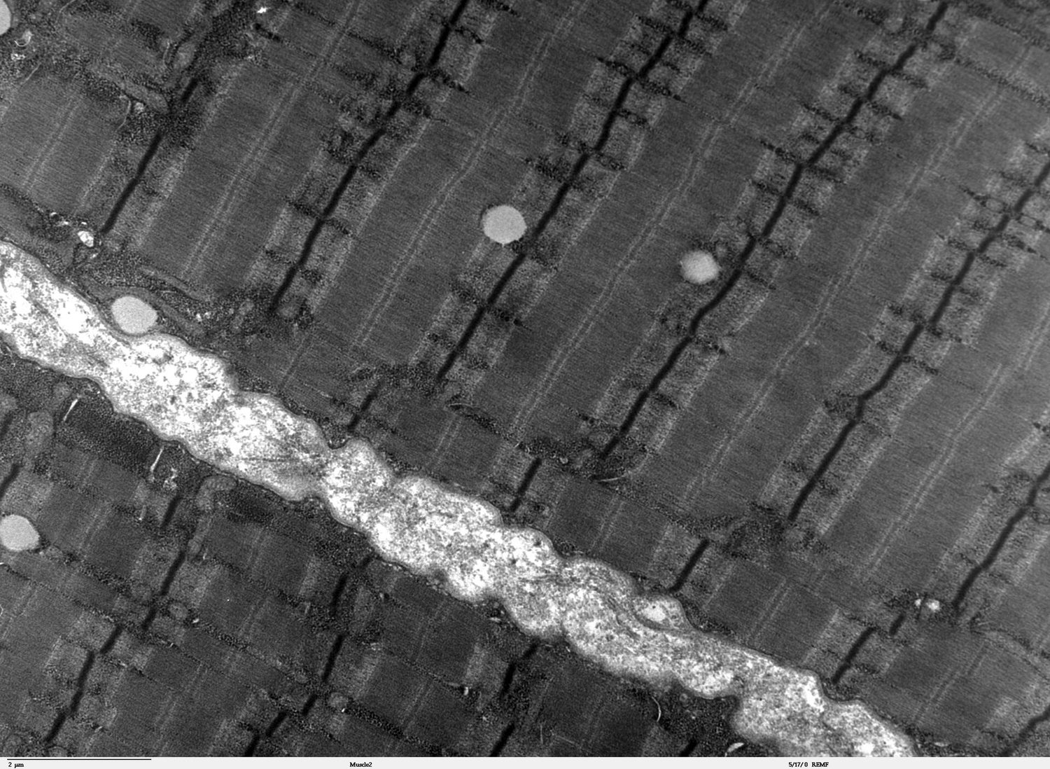 An electron micrograph of muscle showing many parallel fibres crossed by a regular pattern of dark and light stripes