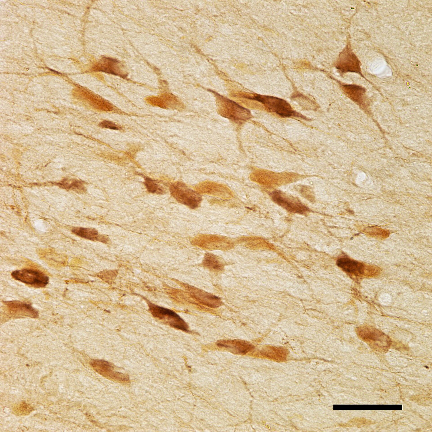 A light micrograph of brain tissue with a scale bar: several neurone cell bodies stained dark brown against a pale background, each with a roughly triangular shape and thin processes reaching out from it