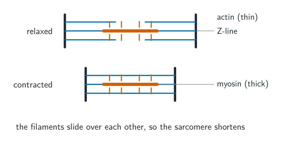 A relaxed sarcomere above a contracted one: the thin actin and thick myosin filaments overlap more in the contracted one, so its Z-lines are closer together