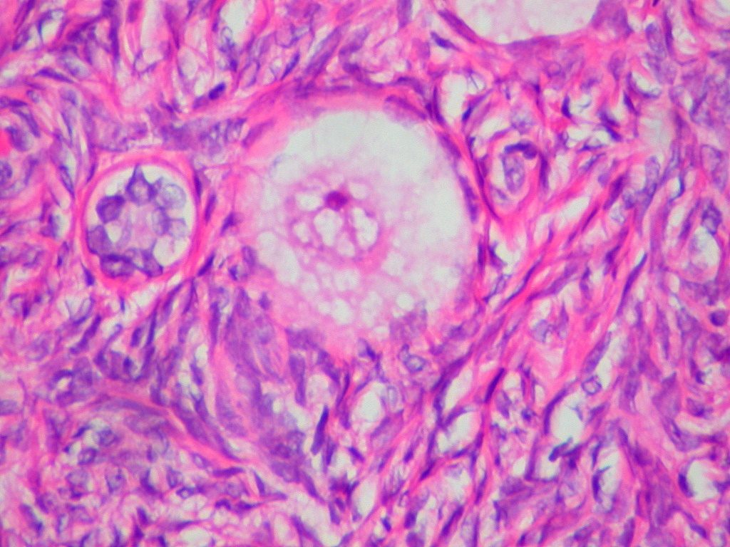 A human egg cell under the microscope