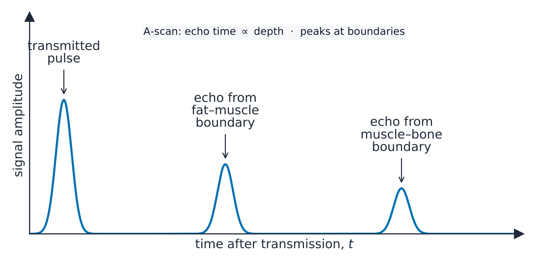 An A-scan trace on an oscilloscope: a large transmitted pulse, then smaller echo pulses from the fat–muscle boundary and the muscle–bone boundary at later times