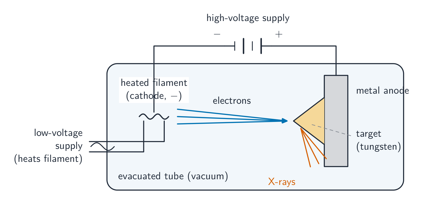 A diagram of an X-ray tube: a heated metal filament (cathode) driven by a low voltage, a high voltage accelerating electrons across an evacuated tube to a metal anode with an angled tungsten target, and X-rays leaving the target