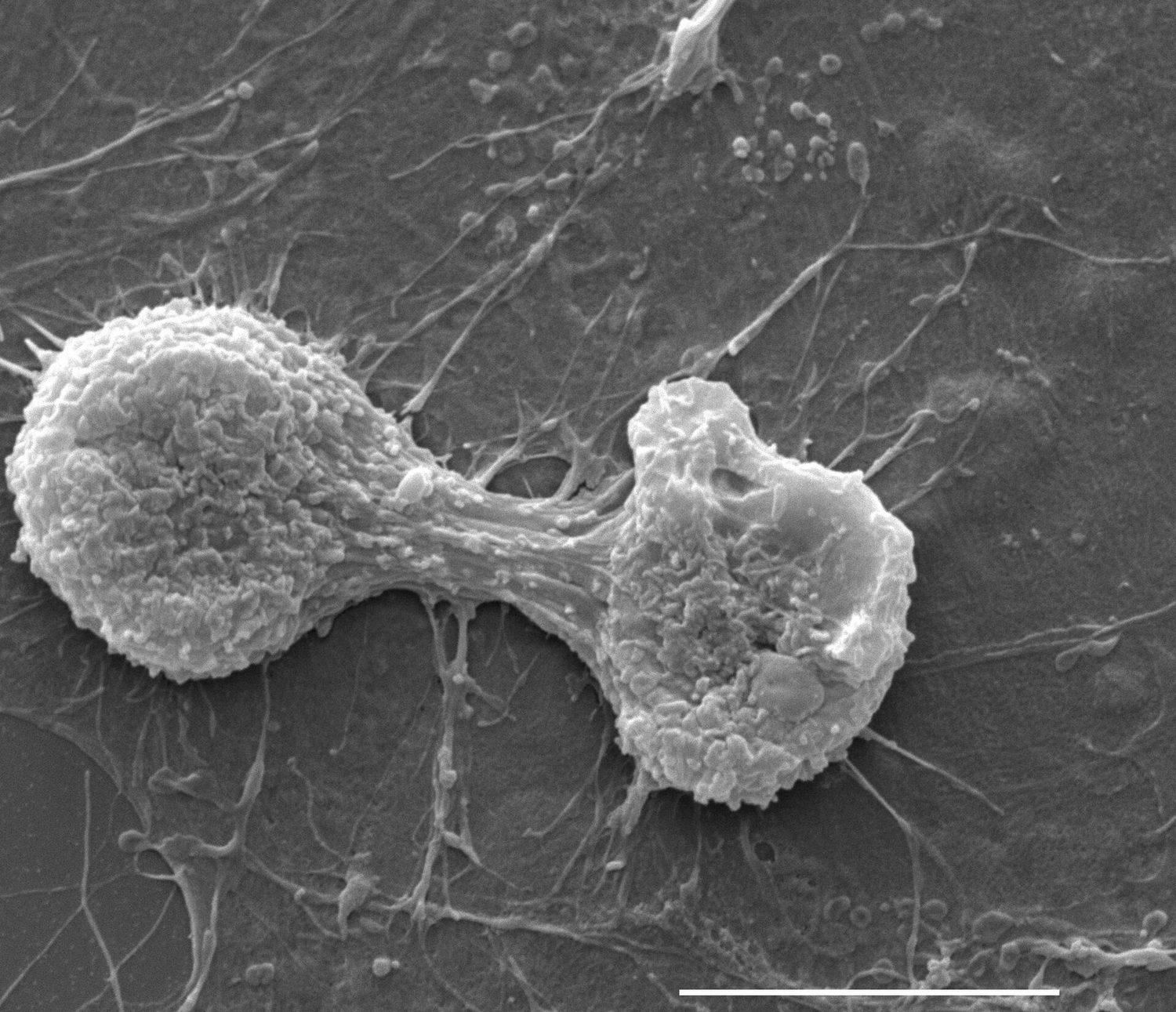 Un fibroblaste en division : la cytokinèse scinde une cellule en deux après la fin de la mitose