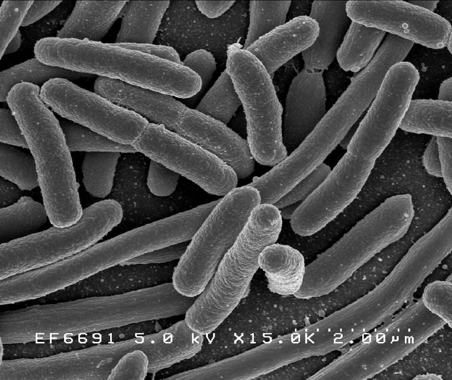 E. coli under a microscope: differential equations model exponential growth of populations