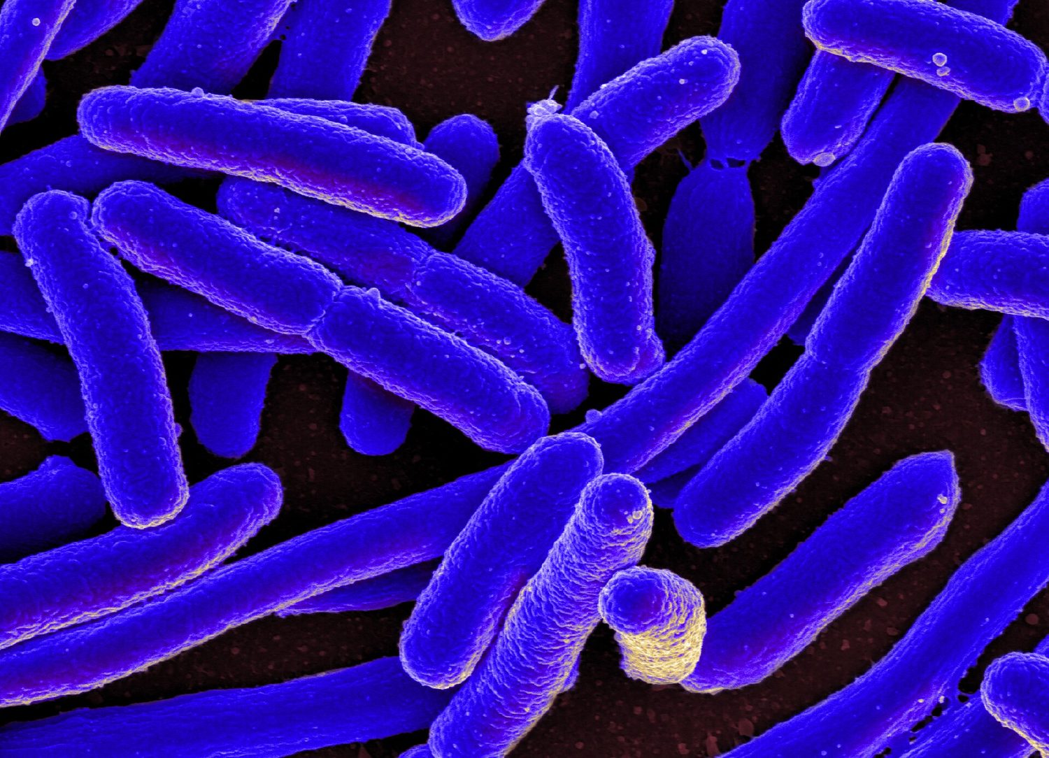 A false-colour electron micrograph of many rod-shaped Escherichia coli bacteria packed together, coloured bright blue