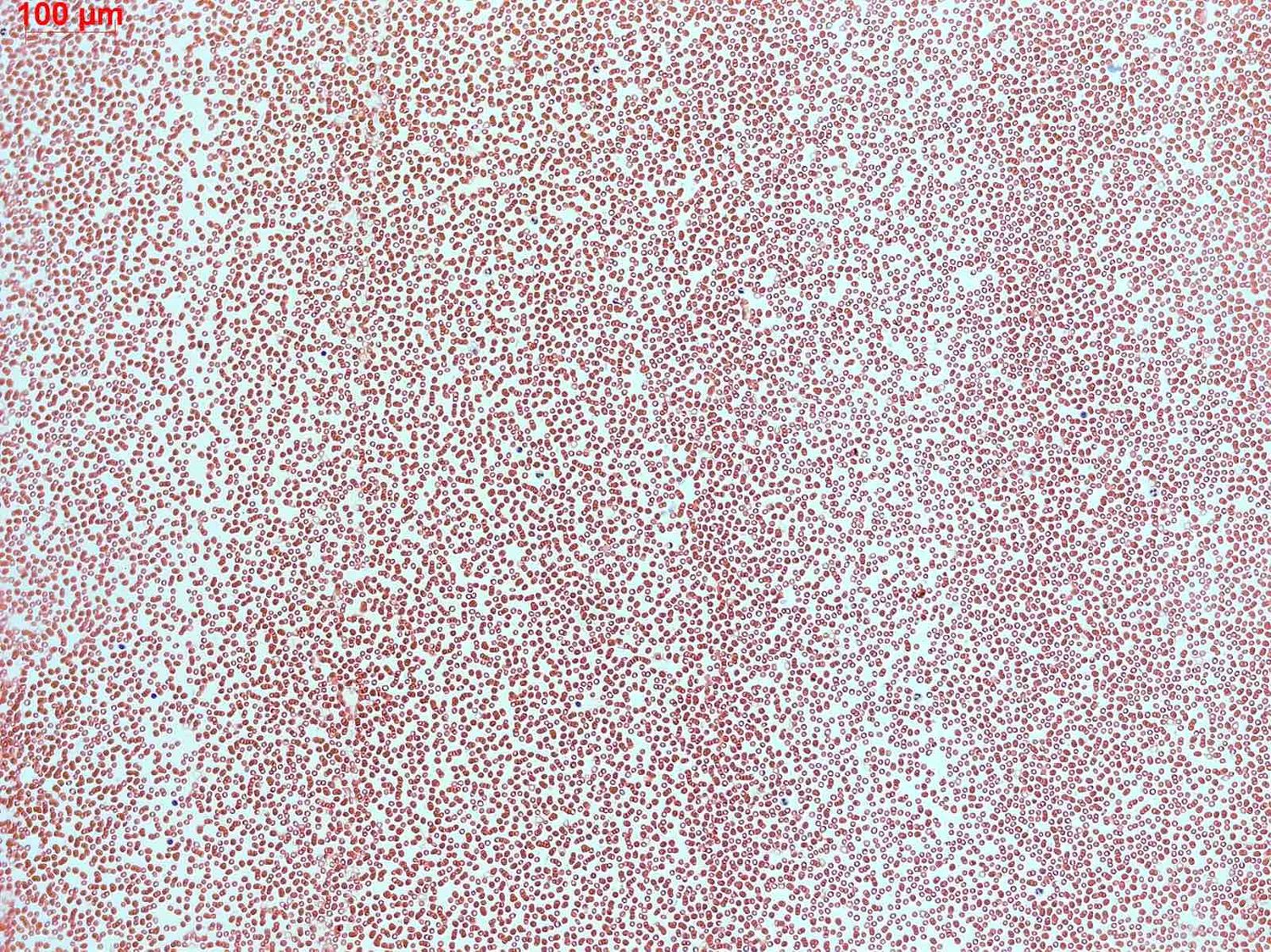 Red blood cells seen under a microscope