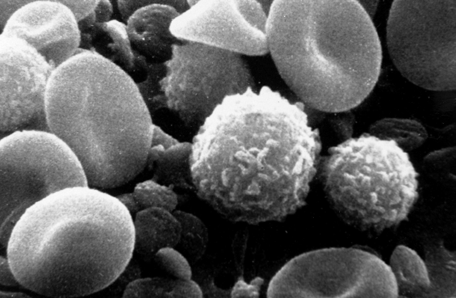 A scanning electron micrograph of real blood cells: many dimpled disc-shaped red cells, two rounded bumpy white cells, and small platelet fragments