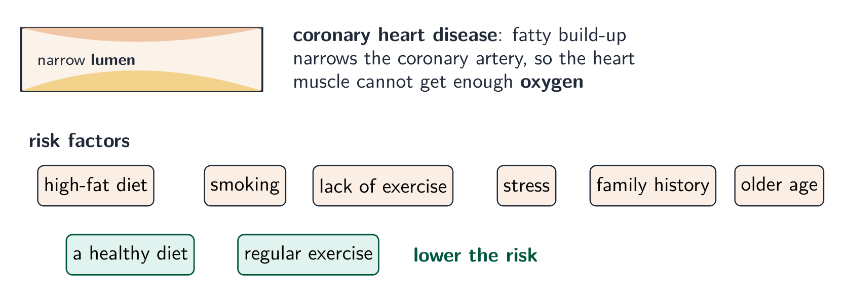 A coronary artery narrowed by fatty build-up so the heart muscle cannot get enough oxygen, with the risk factors listed and a healthy diet and regular exercise shown to lower the risk