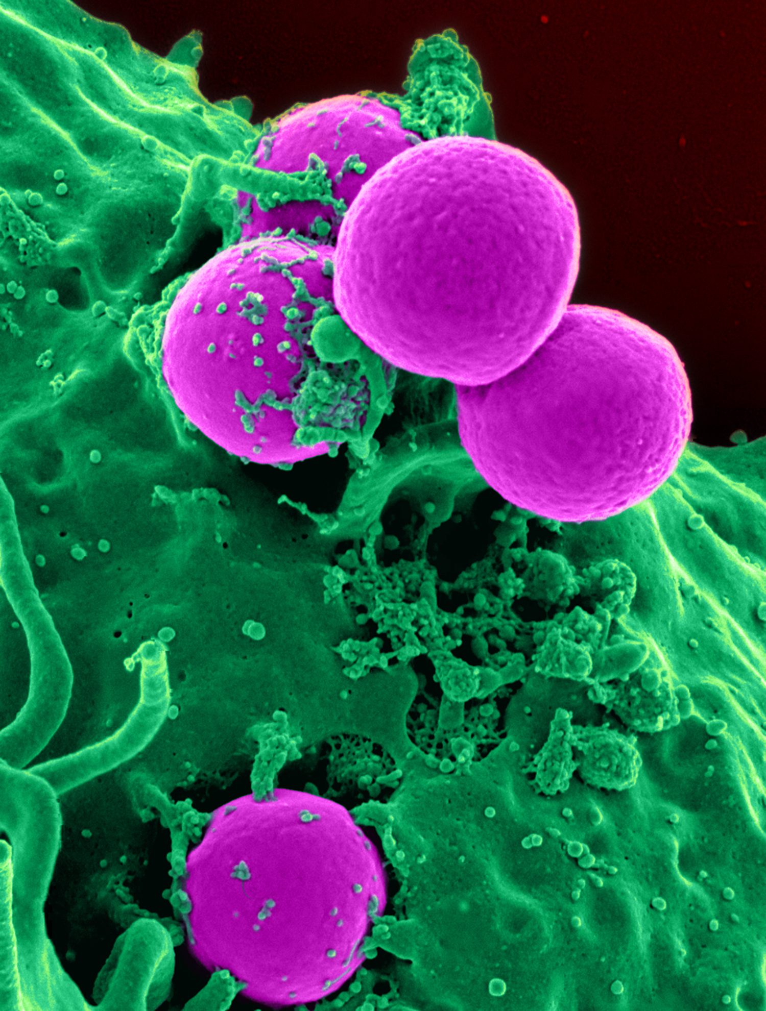 Un globule blanc (vert) engloutissant des bactéries rondes (violet), une défense corporelle clé