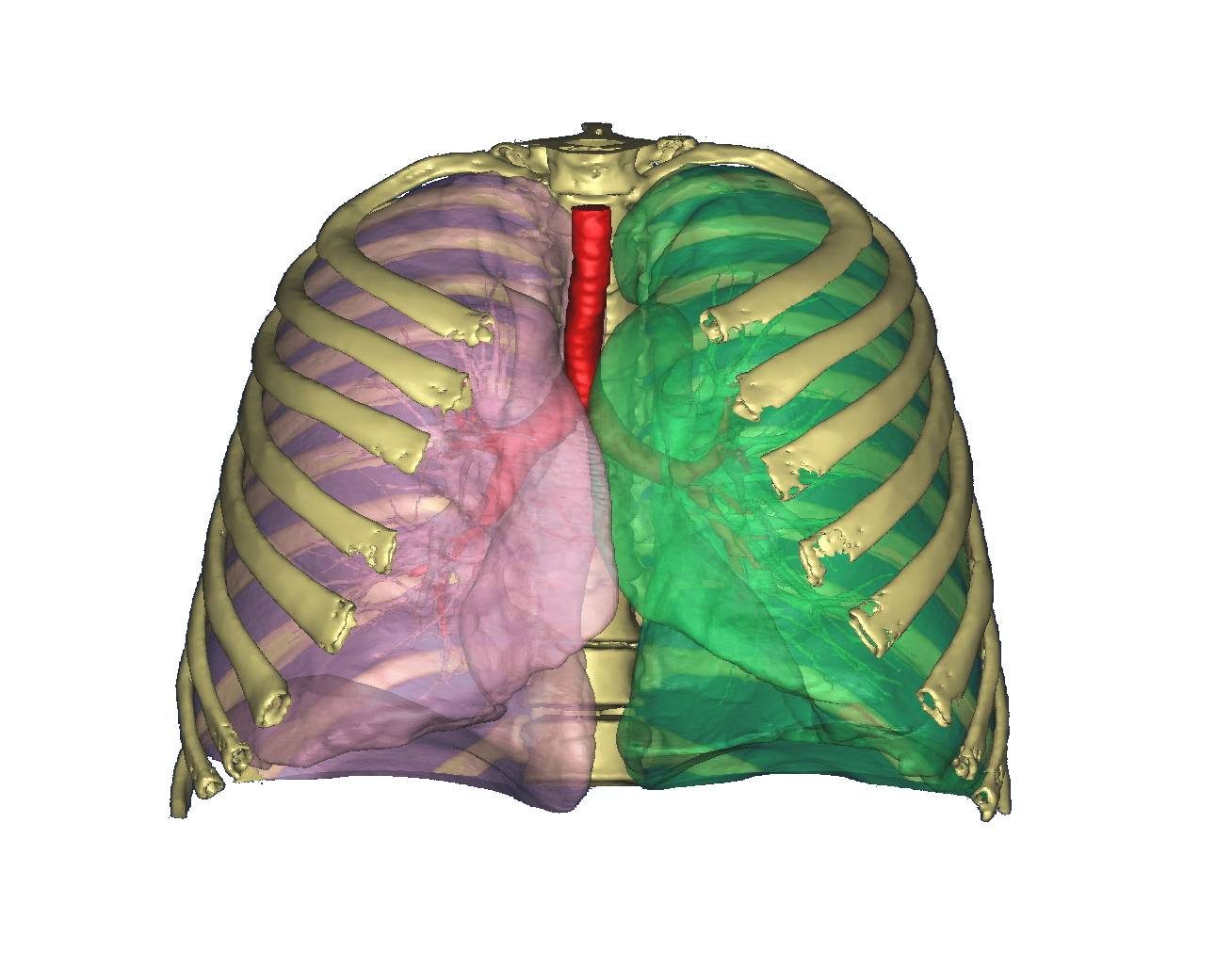 A 3-D model of the lungs and airways