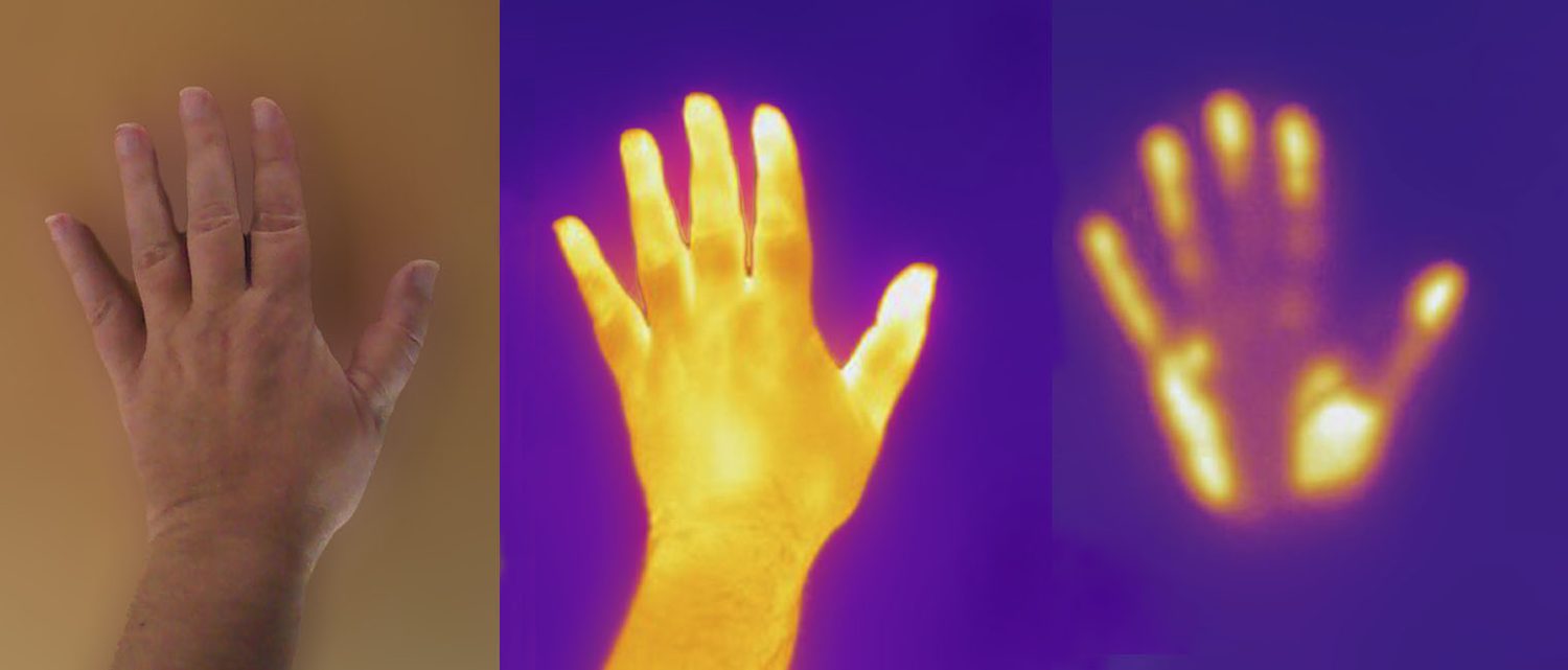 The same hand in ordinary light and through a thermal (infrared) camera