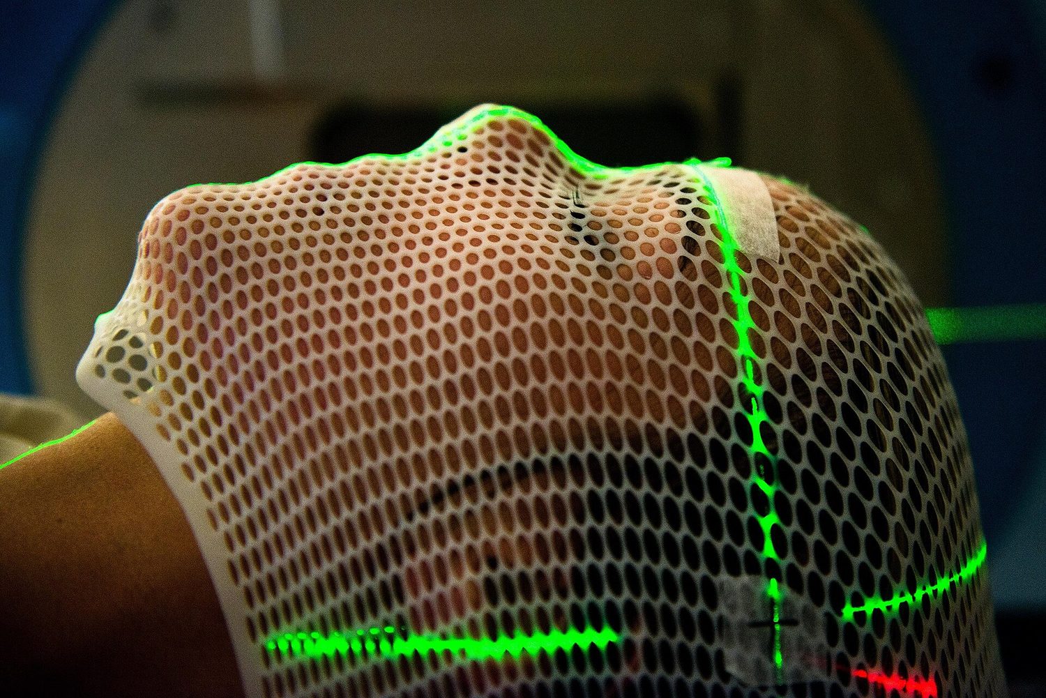 A patient held still by a mesh mask under a radiotherapy machine, with green alignment lasers crossing the mask